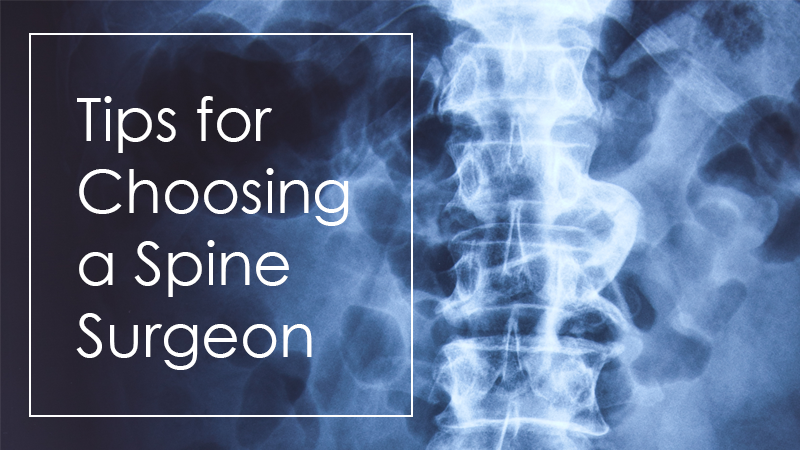 Tips for Choosing a Spine Surgeon