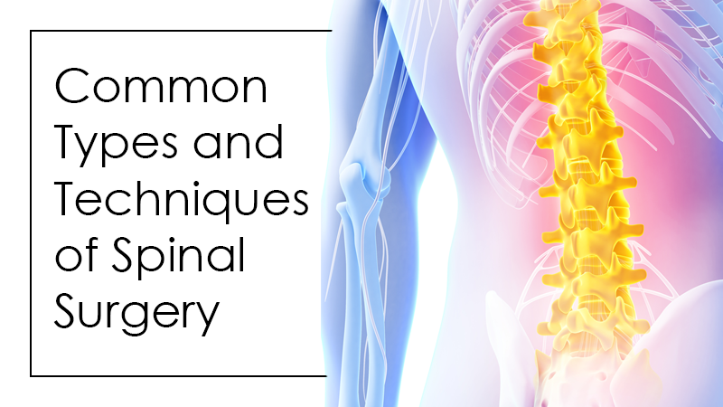 Common Types and Techniques of Spinal Surgery