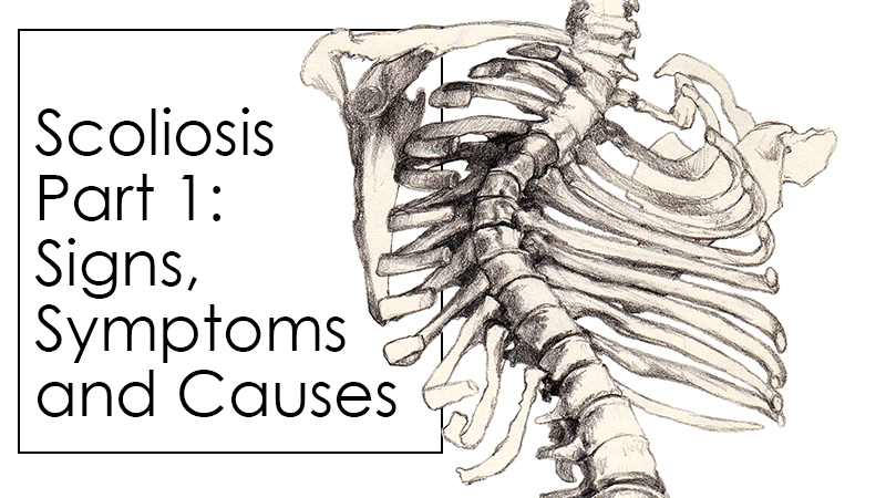 Scoliosis Part 1: Signs, Symptoms and Causes