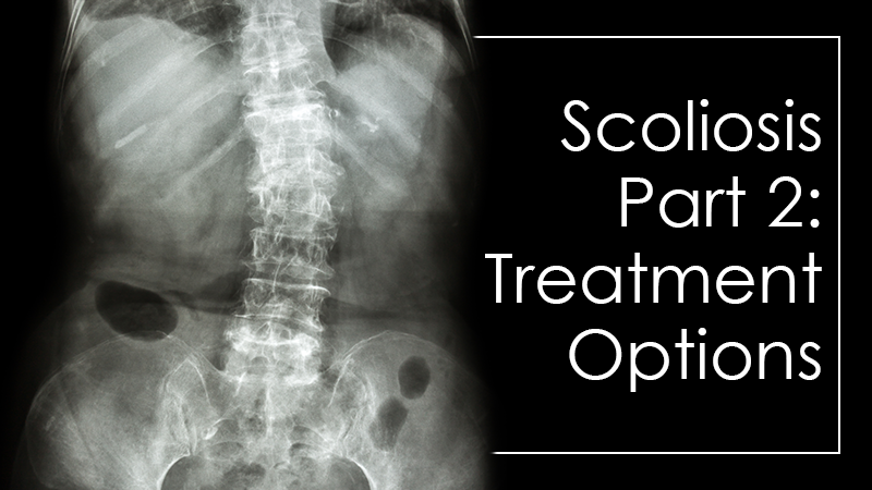 Scoliosis Part 2: My Treatment Options