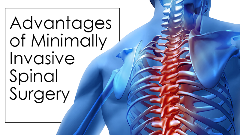 Advantages of Minimally Invasive Spinal Surgery