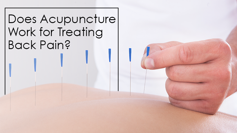 Does Acupuncture Work for Treating Back Pain?
